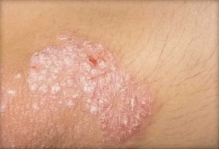 بهترین زمان مصرف سیر سیاه برای لاغری