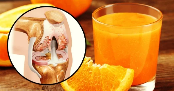 تقویت غضروف زانو با غضروف ساز خانگی و طبیعی