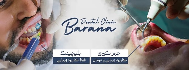 سیگار | ترفند ترفندهای سفید کردن دندان برای افراد سیگاری