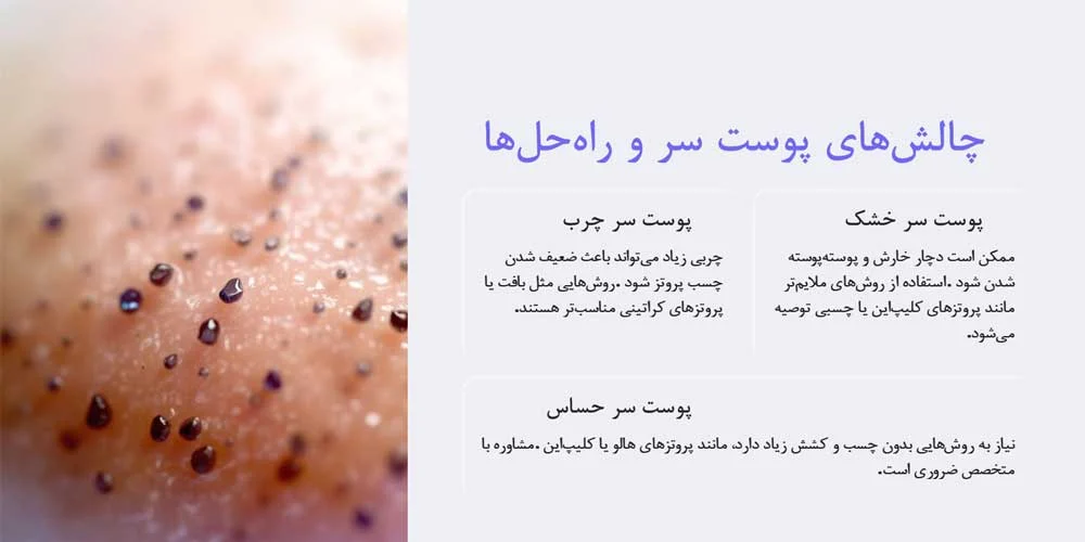پوست آیا پروتز موی طبیعی برای همه انواع پوست سر مناسب است؟ | راهنمای تخصصی 2025