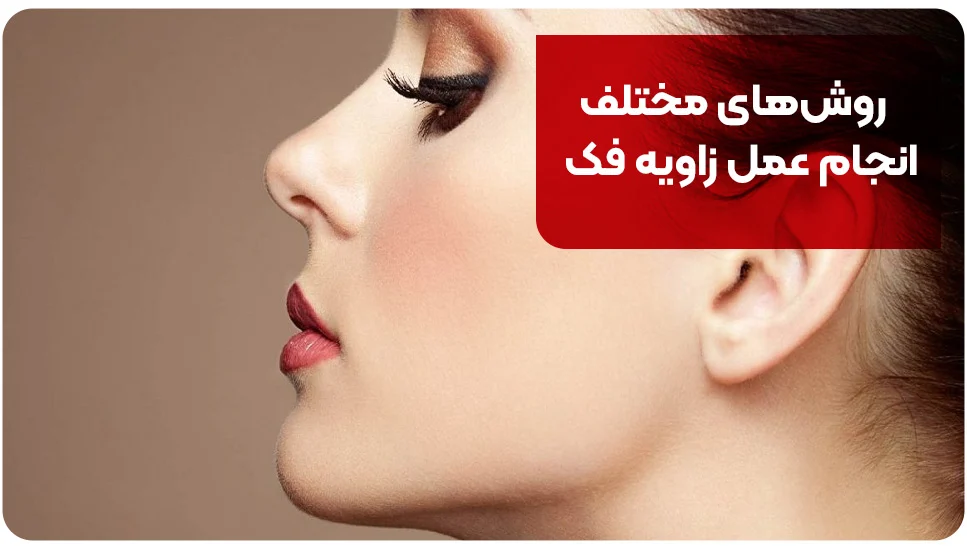 جراحی زیبایی روشهای مختلف انجام عمل زاویه فک